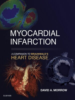 cover image of Myocardial Infarction